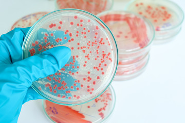 red colony of bacteria in laboratory