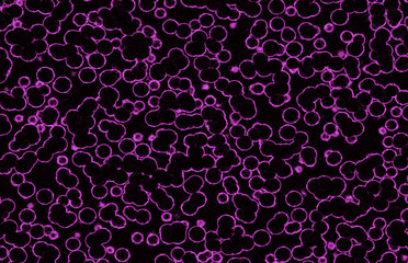 electric bubbles
