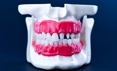 Human jaw with teeth and gums anatomy model