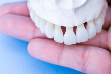 Human hand holding a upper jaw with teeth © .shock