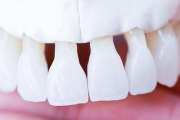 Human hand holding a upper jaw with teeth © .shock