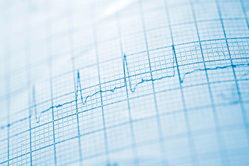 Electrocardiogram close up