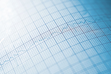 Electrocardiogram close up
