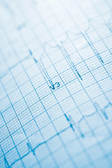 Electrocardiogram close up