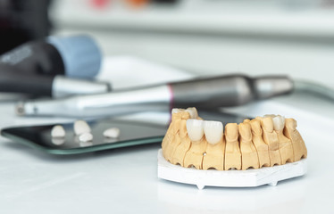 Artificial jaw with veneers and crowns, medical instrument.
