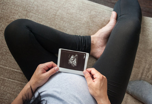 Ultrasound picture in hands of pregnant woman. Preparation for childbirth and motherhood