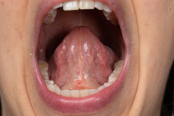 Human tongue hyoid frenum close up