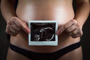 Pregnant woman with x-ray picture of baby color version

 - obrazy, fototapety, plakaty