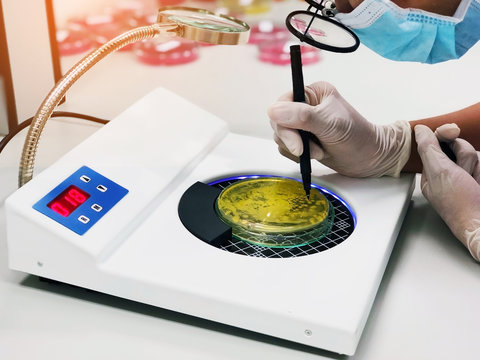 Close up of Scientist counted the colony of Staphylococcus aureus cultured with Mannitol salt Agar in Petri dish show yellow colonies using colony counter in medical health lab for analysis disease.