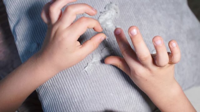 Children's hand skin disease.