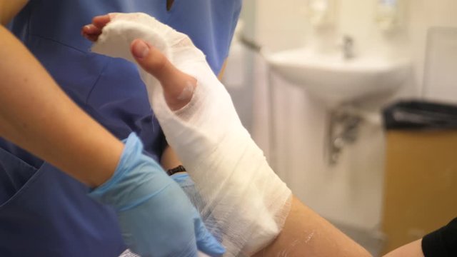 Doctor in the hospital putting on plaster on a broken arm