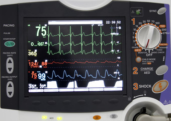 EKG monitor