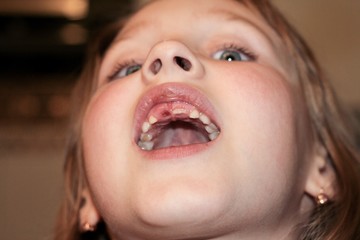 baby's mouth without a tooth