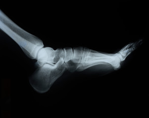 Foot X-ray detail