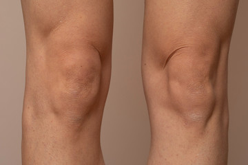 Human knees skin close up