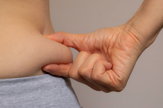 Obesity, excess weight close up