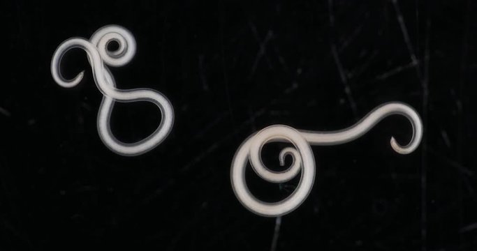 Ascariasis is a disease caused by the parasitic roundworm Ascaris lumbricoides for education in laboratories.