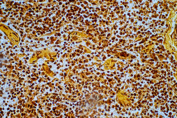 Reticular cell is a type of fibroblast. They are found in many tissues including the spleen, lymph nodes and lymph nodules.