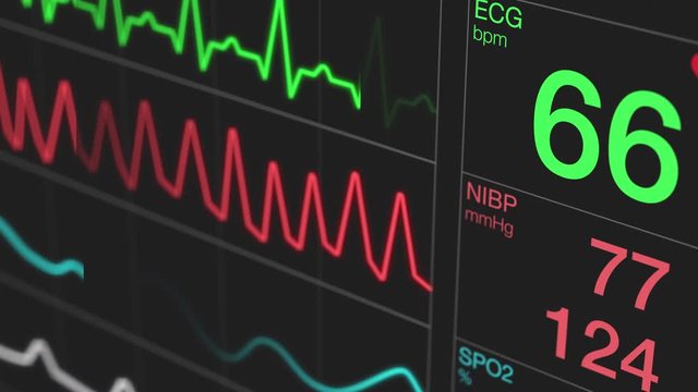 animation of an ecg ekg display