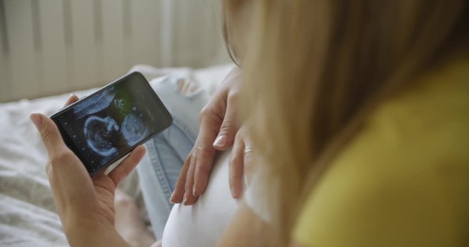 two girls young women lesbians expect a baby and look at a picture of an ultrasound scan on the phone. lgbt