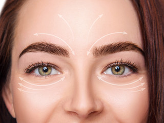 Lifting arrows showing facial anti-aging effect on skin.