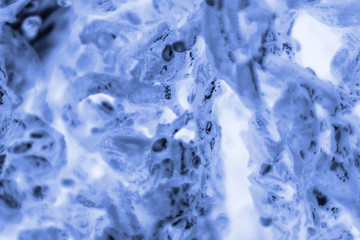 PC-3 human prostate cancer cells stained with blue Coomassie, under a differential interference...