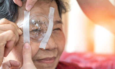 Cataract treatment after surgery by caregiver concept. Asia old woman placed protective shield over...