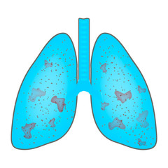 Lungs affected by pneumonia. World Pneumonia Day. The anatomical structure of the lungs. Infographics. Vector illustration on isolated background.