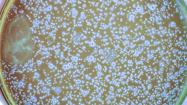 Growing Bacterial Colonies In Petri Dish, Time Lapse. growth of bacteria taken in a bathroom in a Petri dish