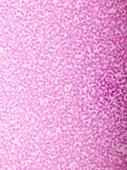 Red blood cells in blood smear, Wright-Giemsa stain, analyze by microscope, 400x