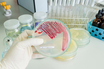 colony of bacteria in petridish with microbiology concept