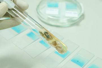 colony of fungi in test tube with microbiology concept
