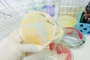 colony of bacteria in petridish