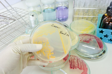 Fototapeta na wymiar colony of bacteria in petridish