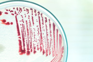 colony of bacteria in petridish
