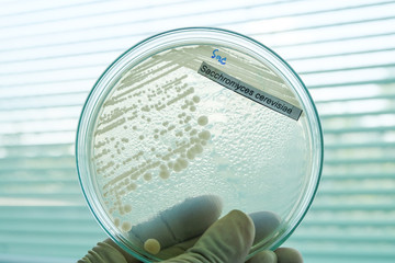 colony of bacteria in petridish