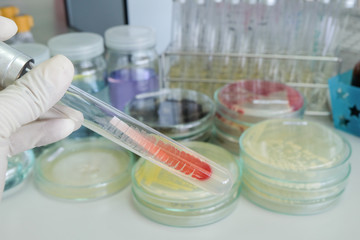 colony of bacteria in test tube