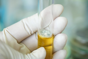 colony of fungi in test tube with microbiology concept
