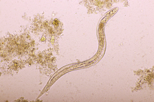 Strongyloides stercoralis or threadworm in human stool, analyze by microscope, original magnification 400x