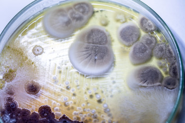 Mold Beautiful, Colony of Characteristics of Fungus (Mold) in culture medium plate from laboratory microbiology.