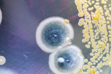 Mold Beautiful, Colony of Characteristics of Fungus (Mold) in culture medium plate from laboratory...