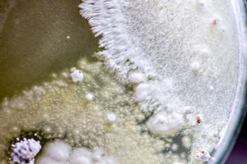 Mold Beautiful, Colony of Characteristics of Fungus (Mold) in culture medium plate from laboratory microbiology.