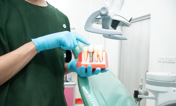 Male dentist carrying a sample of dental implants.