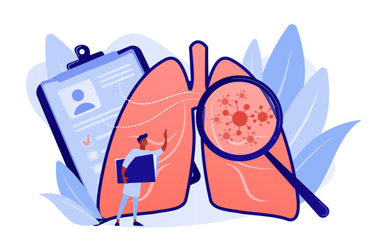 Huge magnifier showing cancer in the lungs and doctor with document folder. Lung cancer, trachea and bronchus concept on white background. Pinkish coral bluevector vector isolated illustration