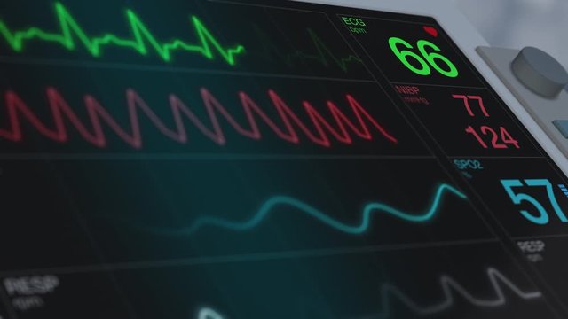 closeup view of an ecg ekg monitor on a operating room (3d render)