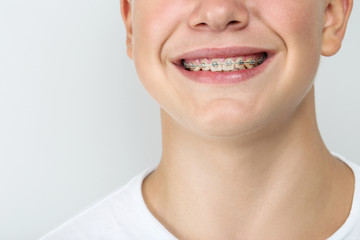 Obraz premium Young man with dental braces on grey background