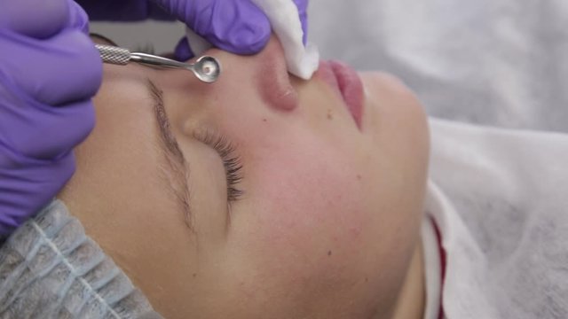 beautician squeezing pimple blackheads for young wonan in beauty salon. facial skin care