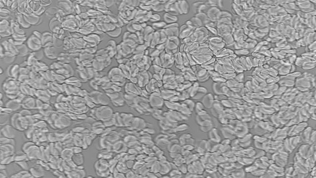 Blood under the microscope, the rapid movement of red blood cells in the blood 4K