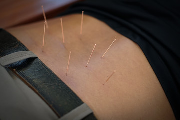 Man Traditional Chinese Medicine Acupuncture.