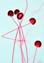 Adult form of the fungus, rhizobium under microscope